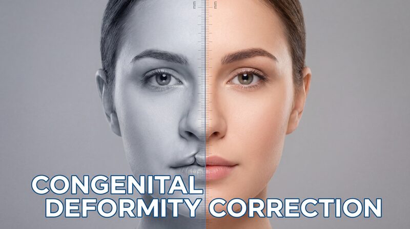 Congenital Deformity Correction (Cleft Lip Nose, etc.)