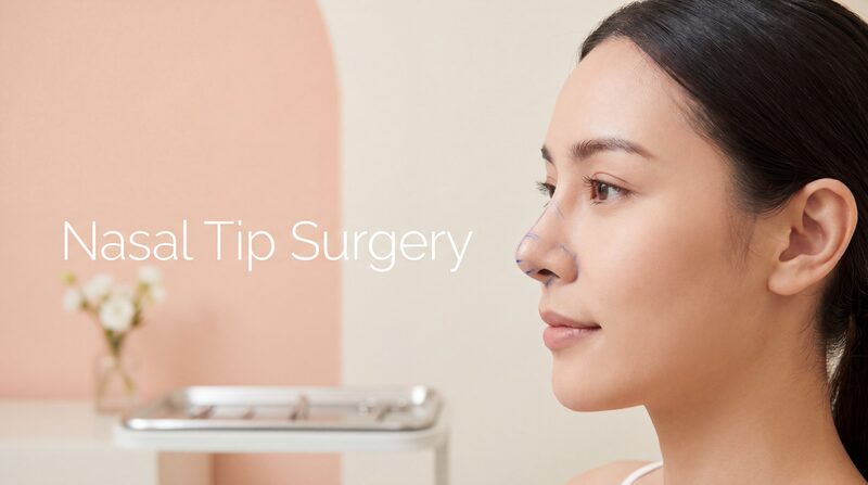 Nasal Tip Surgery
