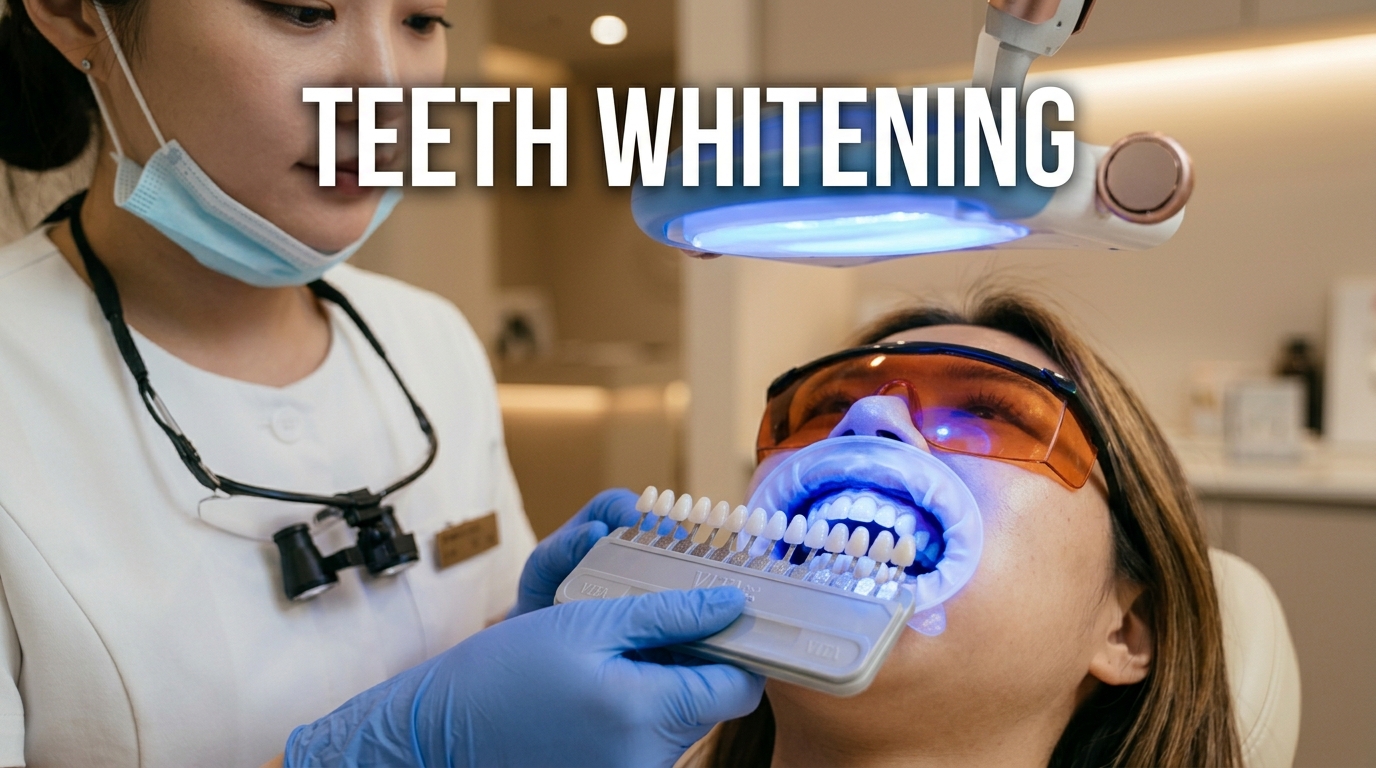Teeth Whitening