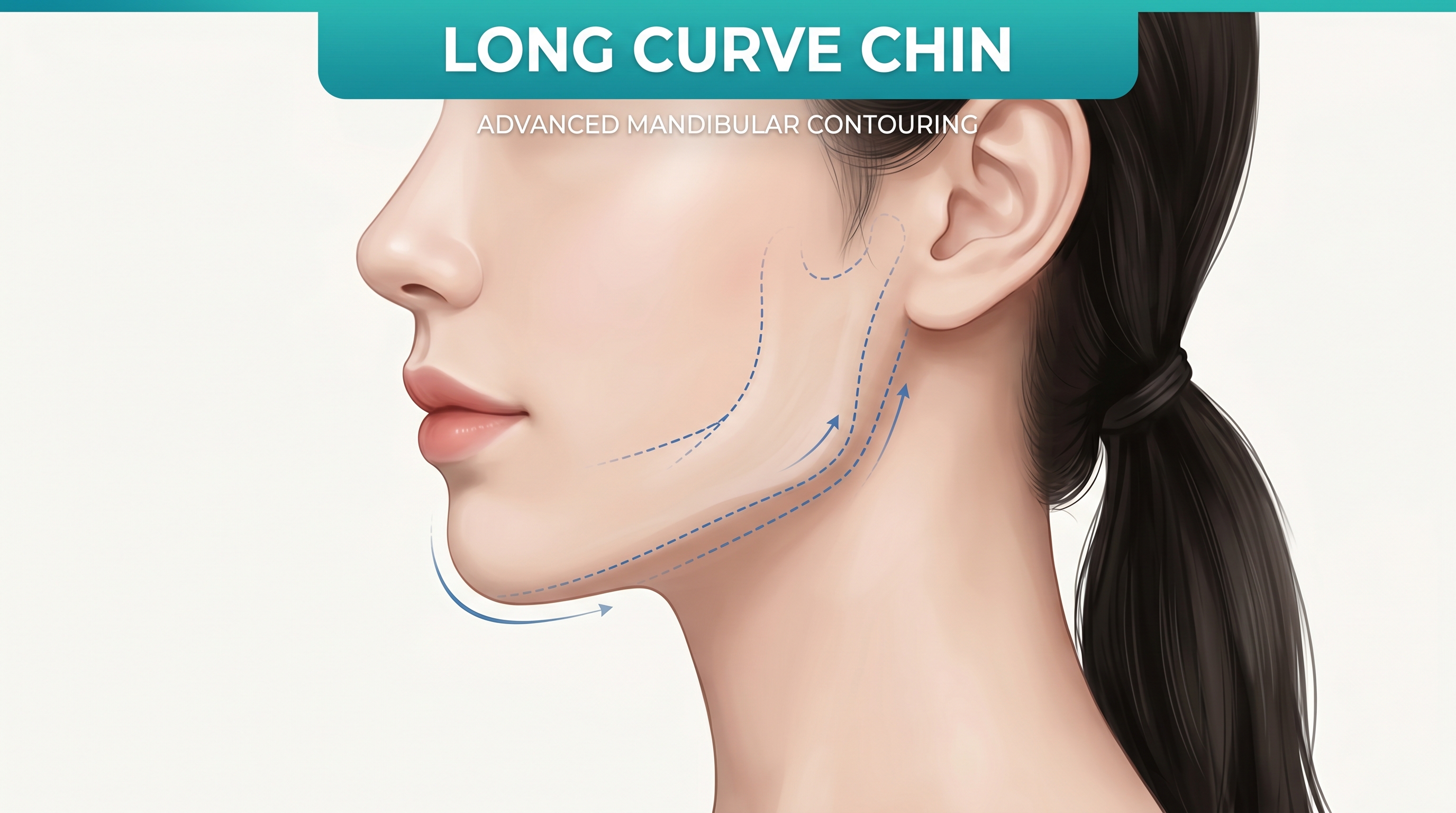 Long Curve Chin